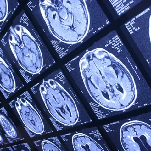 Rows of square screens showing MRI brain scans